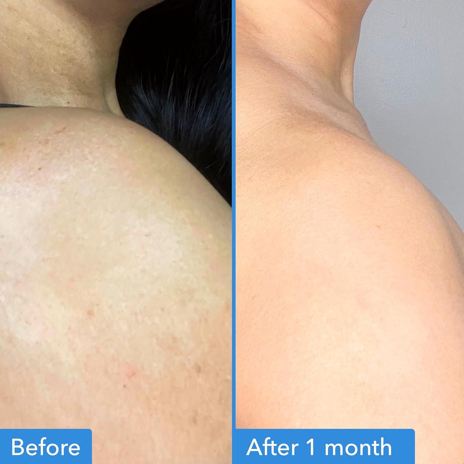 imageGood Molecules Discoloration Correcting Body Treatment AntiPigment Cream with Niacinamide Tranexamic Acid Target Dark Spots and Moisturize Skincare for Body
